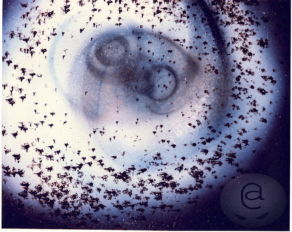 embryo watermarked